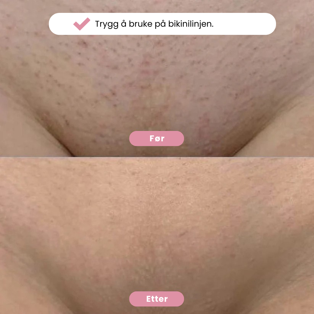 Eulyta™ SilkyTrim Bikini Trimmer