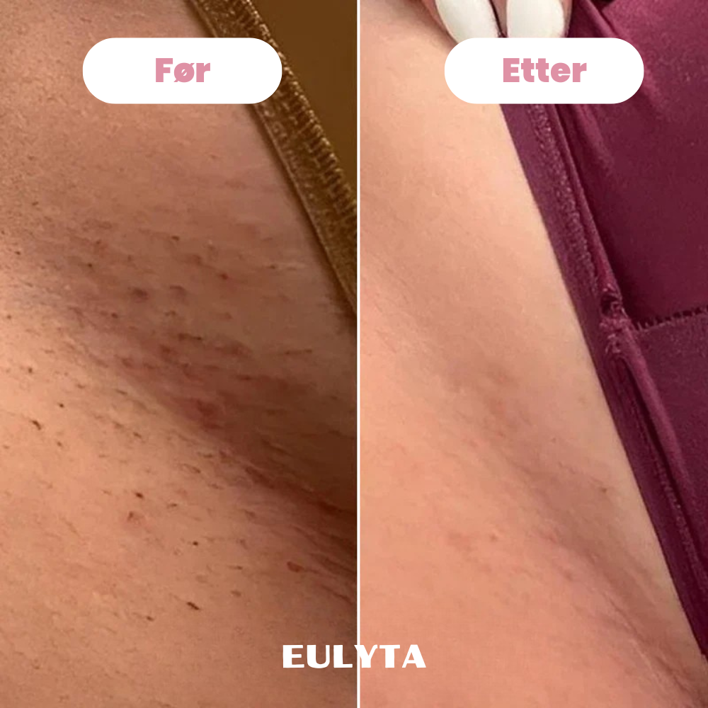 Eulyta™ SilkyTrim Bikini Trimmer
