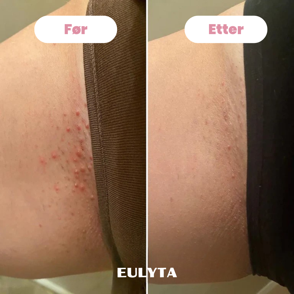 Eulyta™ SilkyTrim Bikini Trimmer