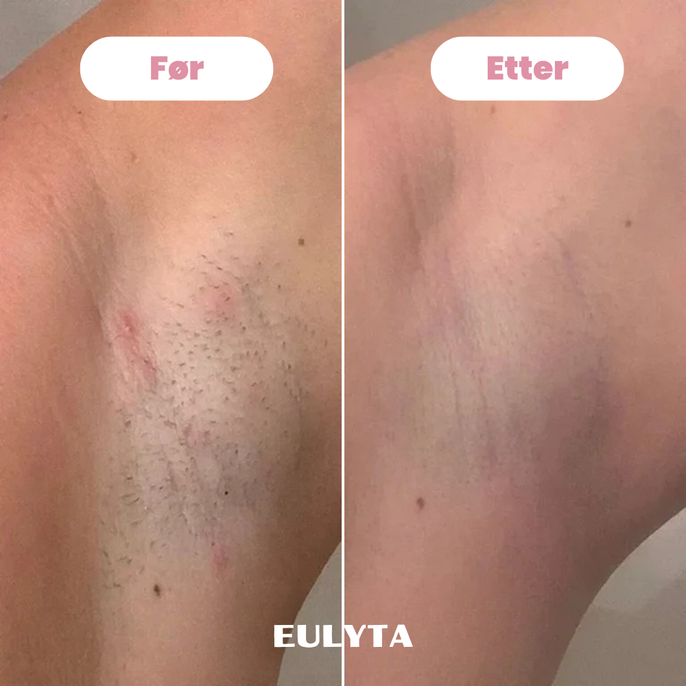 Eulyta™ SilkyTrim Bikini Trimmer