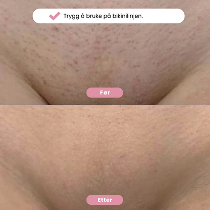 Eulyta™ SilkyTrim Bikini Trimmer