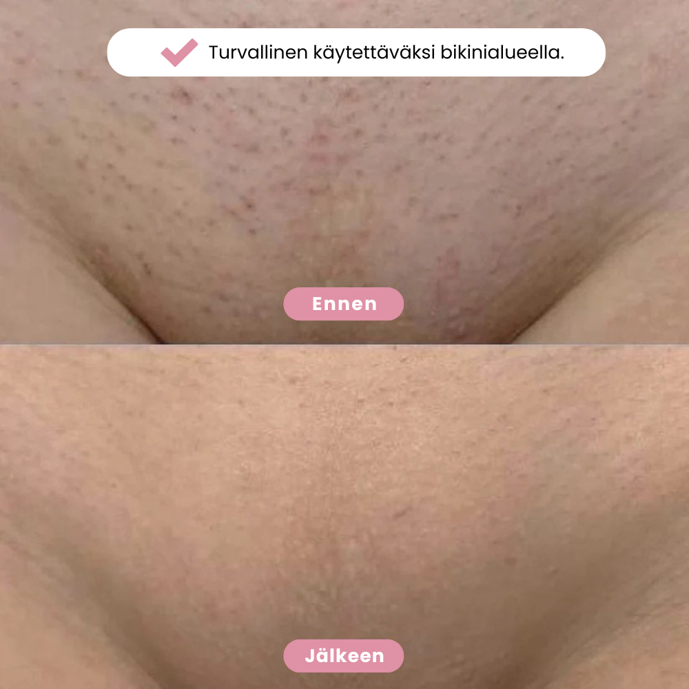 Eulyta™ Bikini Trimmeri