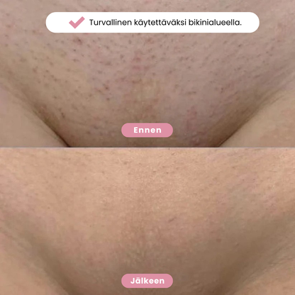 Eulyta™ Bikini Trimmeri