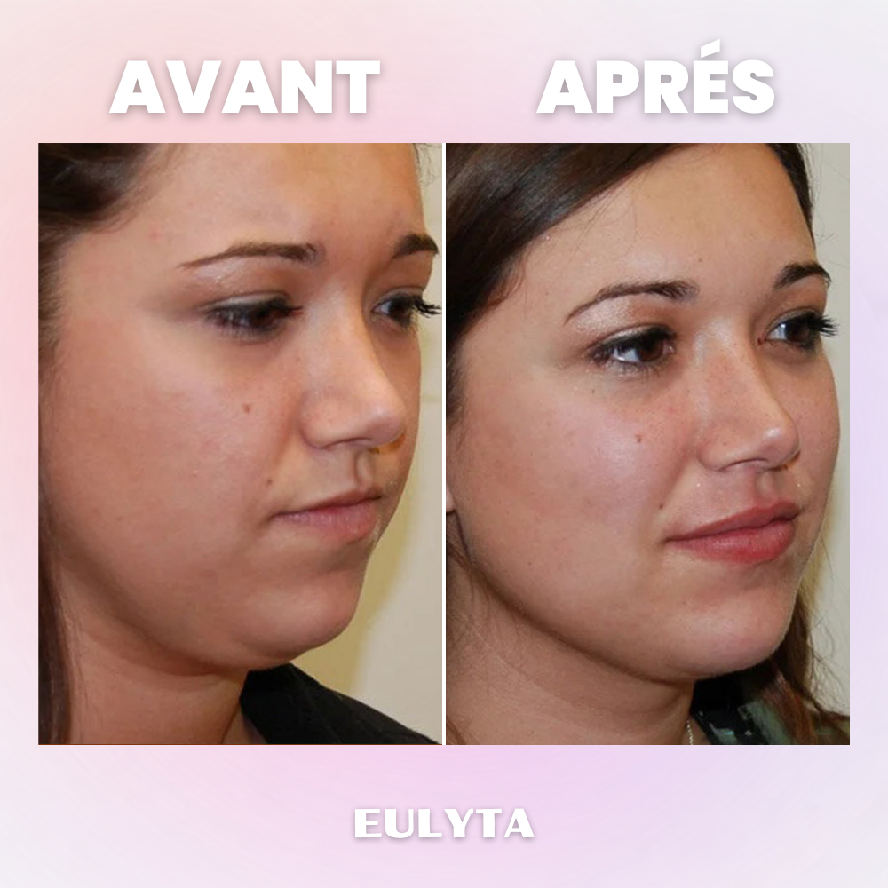 Eulyta™ Brosse Lymphatique Sculptante Visage