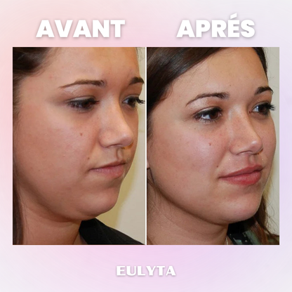 Eulyta™ Brosse Lymphatique Sculptante Visage